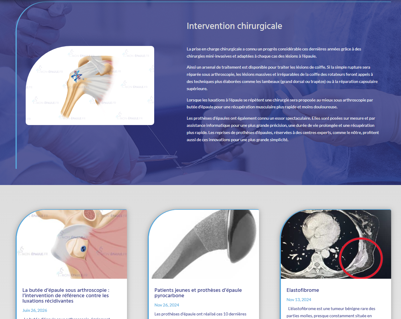 Catégorie Intervention chirurgicale du blog Mon-Epaule.fr présentant plusieurs articles consacrés à la chirurgie de l'épaule